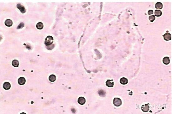 如何看懂自己的「尿常规」,各项指标有什么意义? - 知乎