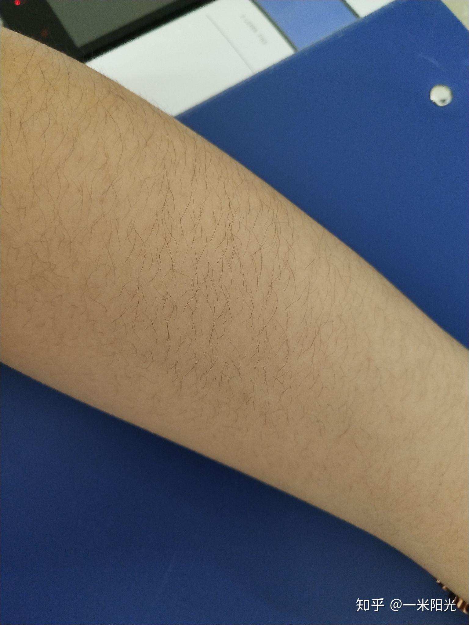 女生汗毛重是怎样的一种体验