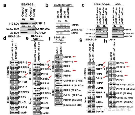 《Environ Int》解读：lncRNA调控剪切！ABHD11-AS1与SART3互作并调控CD44 RNA剪接促进肺癌发生 - 知乎