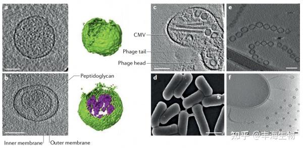 什么是细菌囊泡