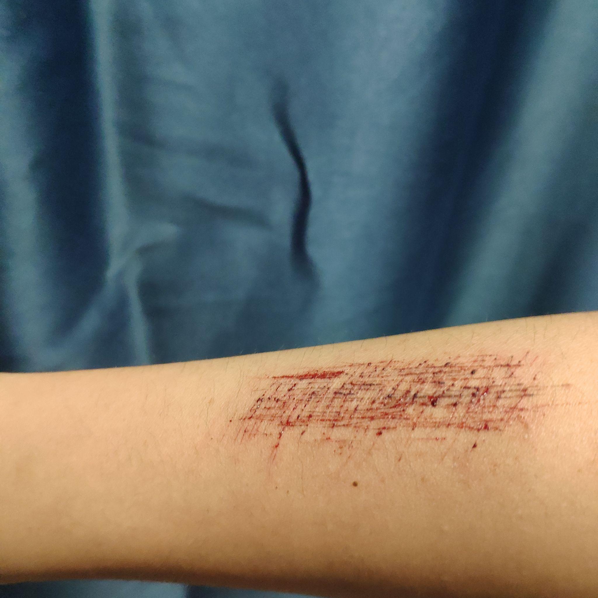 自残的人是什么心理