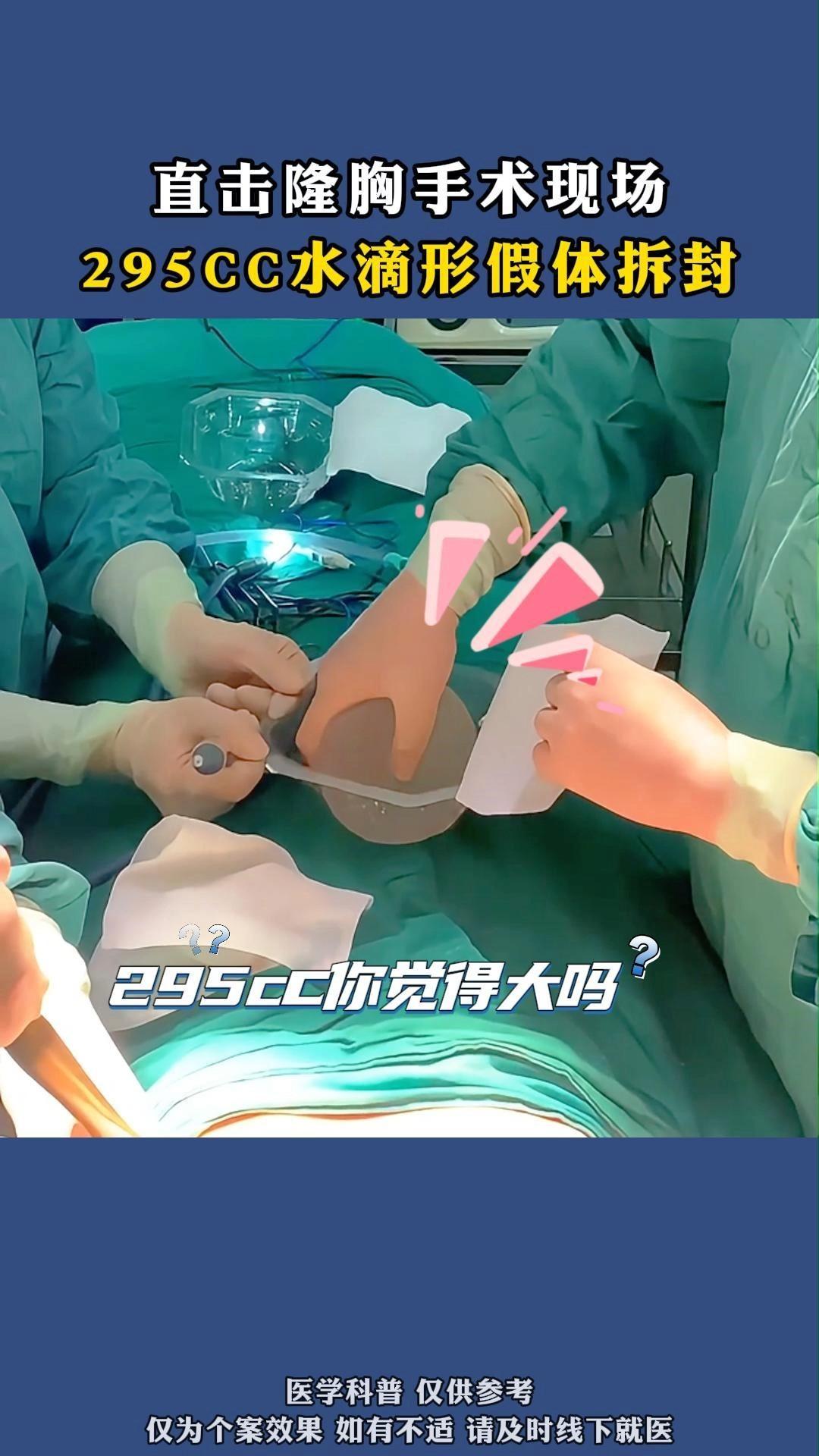 直击隆胸手术现场,295cc毛面水滴形假体植入