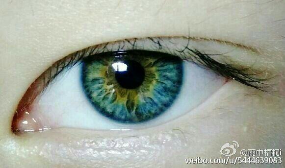 现实中人类异色瞳虹膜异色症的概率是多少