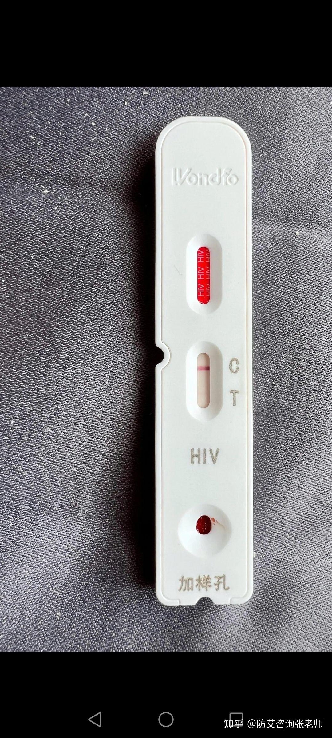 关注问题 67 写回答 登录/注册 hiv hiv检测 艾滋病排除 请问hiv