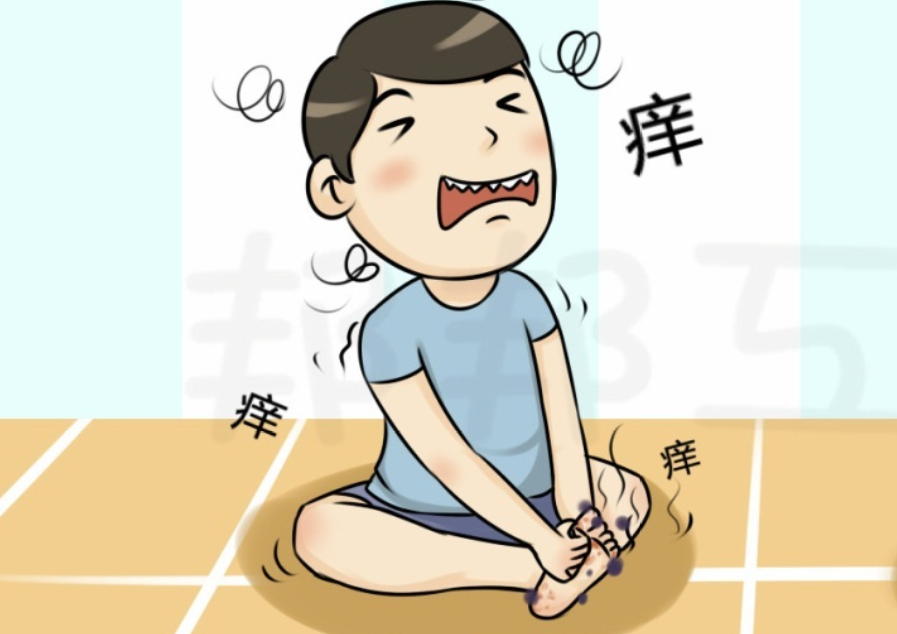 你是怎么根治好脚气的