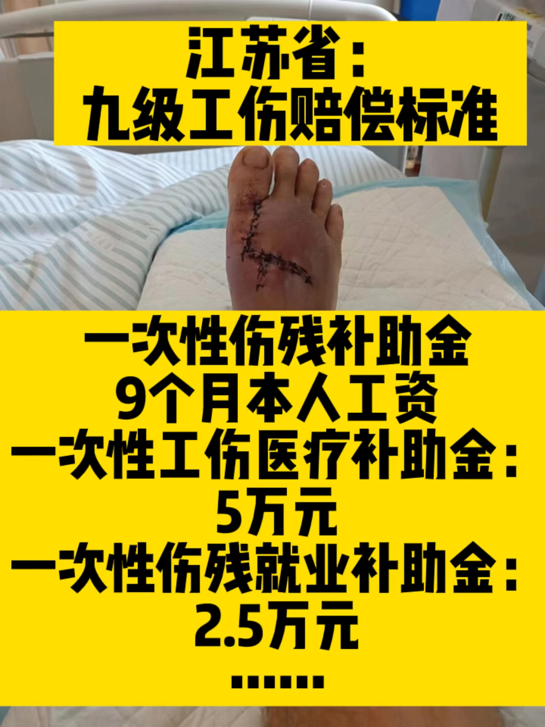 工伤九级伤残赔偿明细我是江苏的我的工伤等级是九级怎么赔?