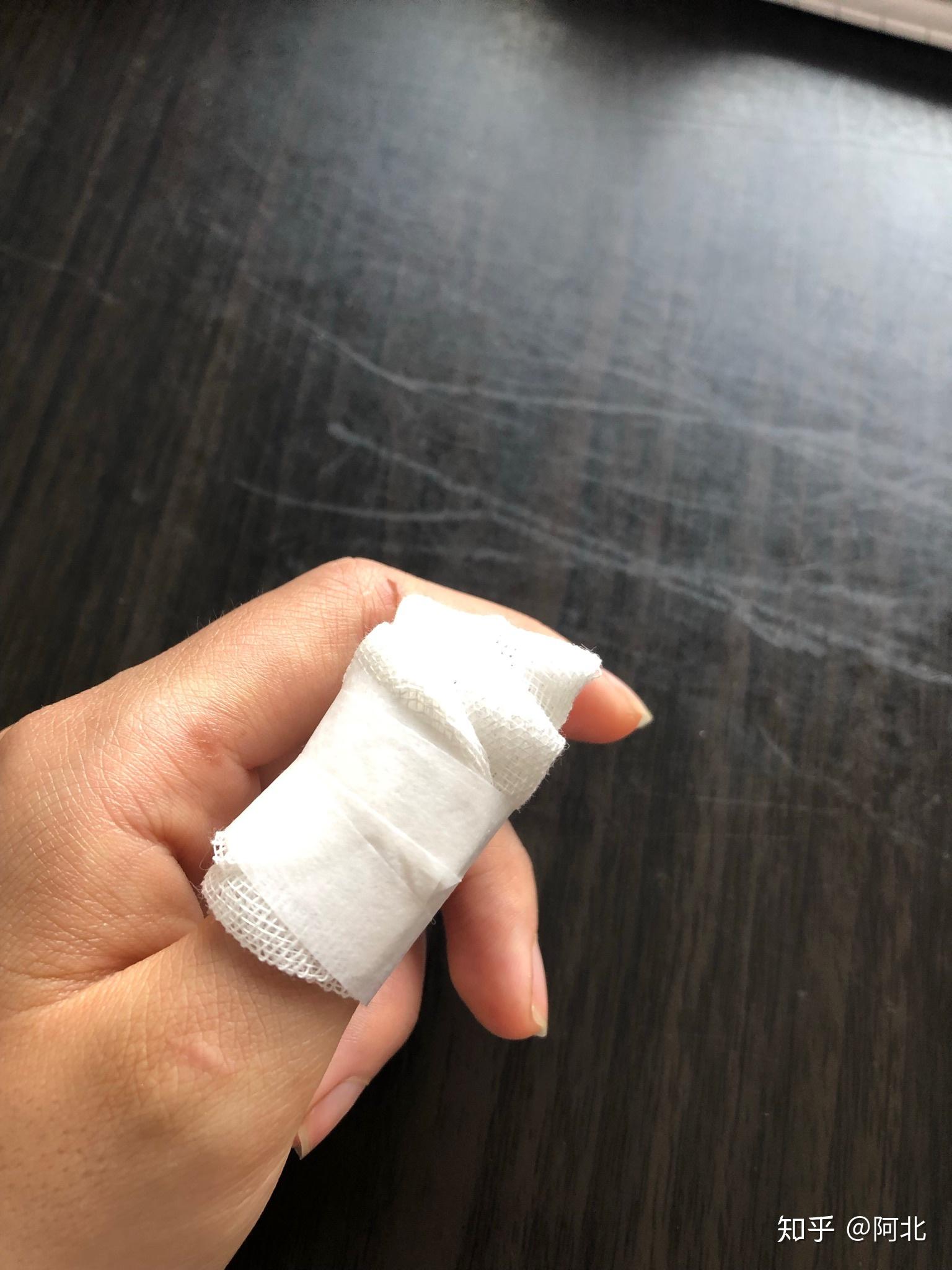 手指被门夹肿还夹出淤血是什么感受? - 知乎
