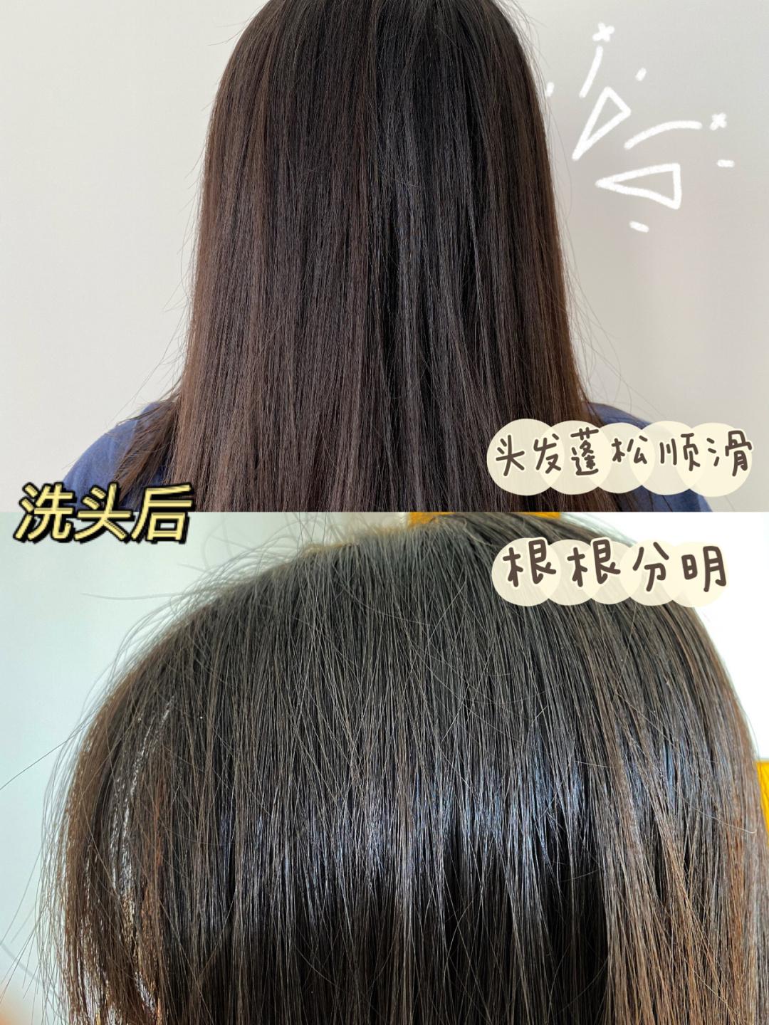 油性发质而且掉头发一般一天洗一次头发用什么洗发水比较好