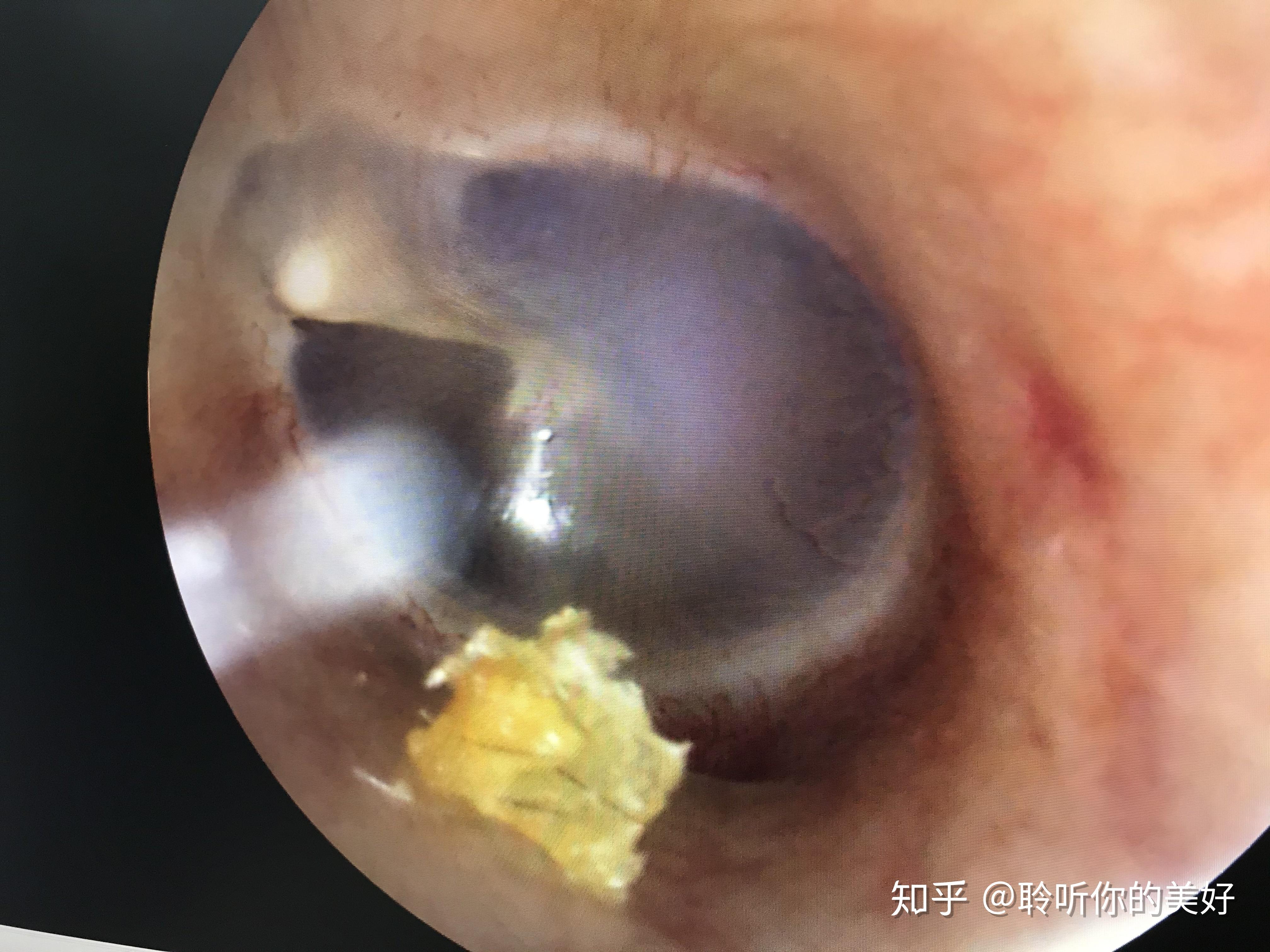 是不是什么东西都进不去了? - 知乎