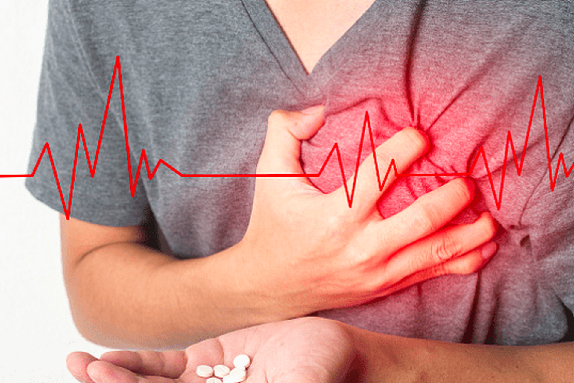 在医学上，「心梗」和「心脏骤停」是同一回事吗？