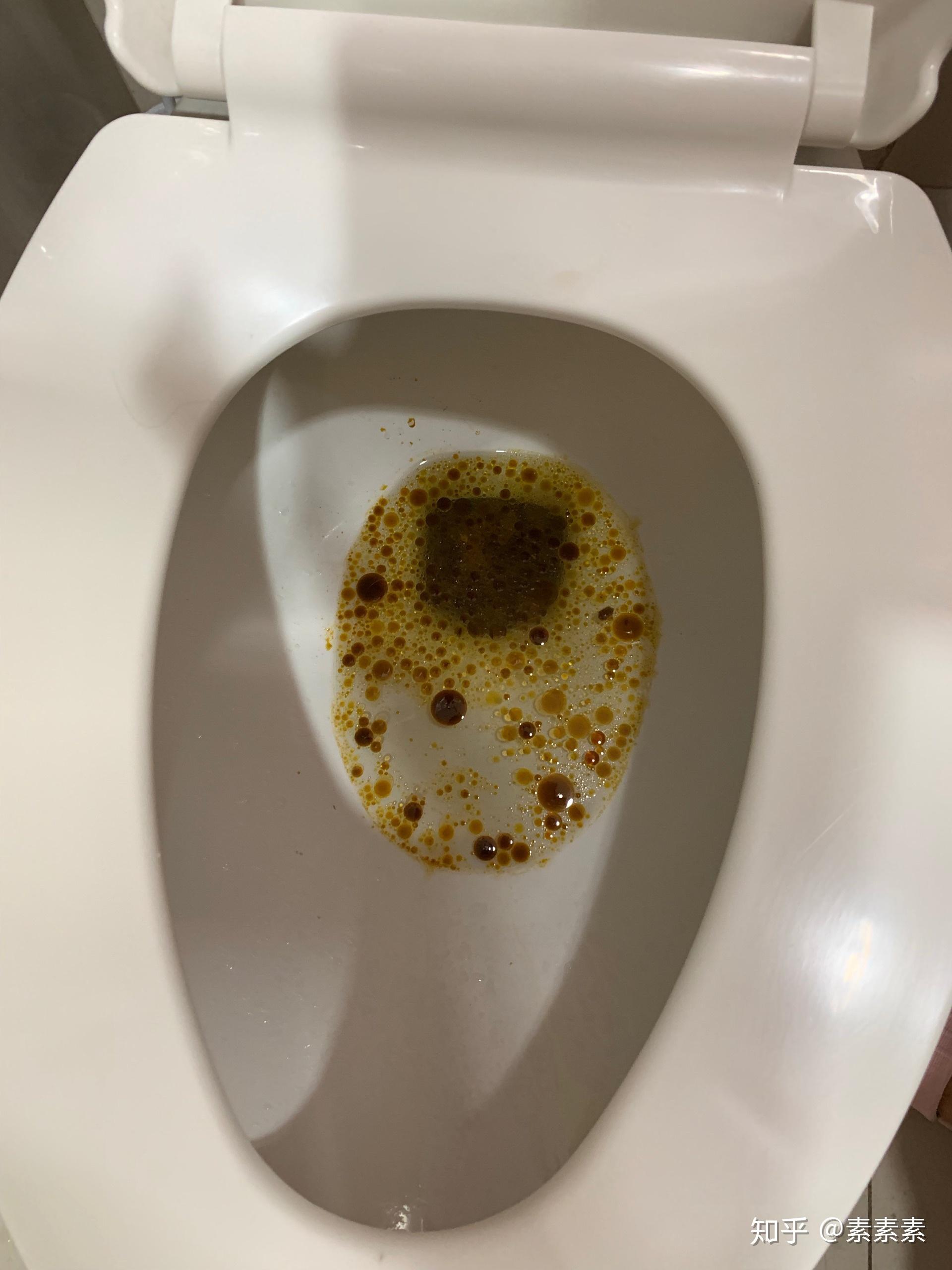 近期很流行的排油丸伤害健康吗?