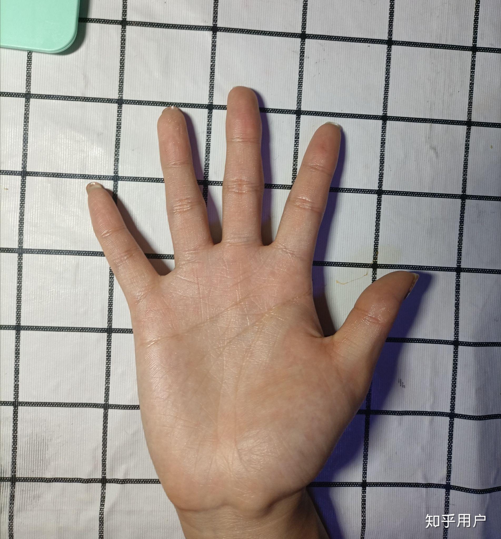 手掌大手指短是一种什么体验? 