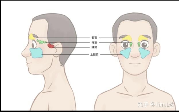 鼻竇炎的致病原因是什麼該如何預防和日常護理呢