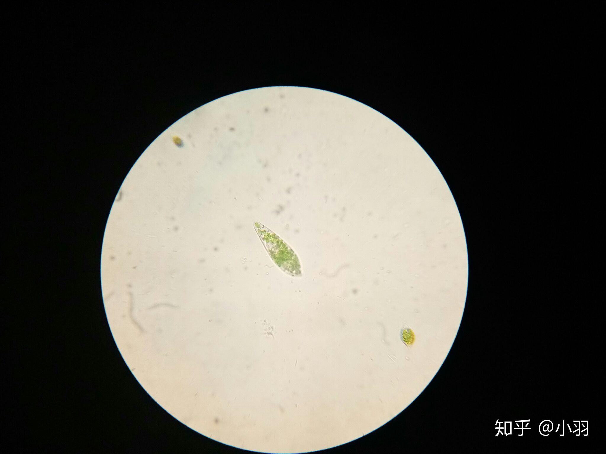 如何在野外找到天蓝喇叭虫(stentor coeruleus)? - 知乎