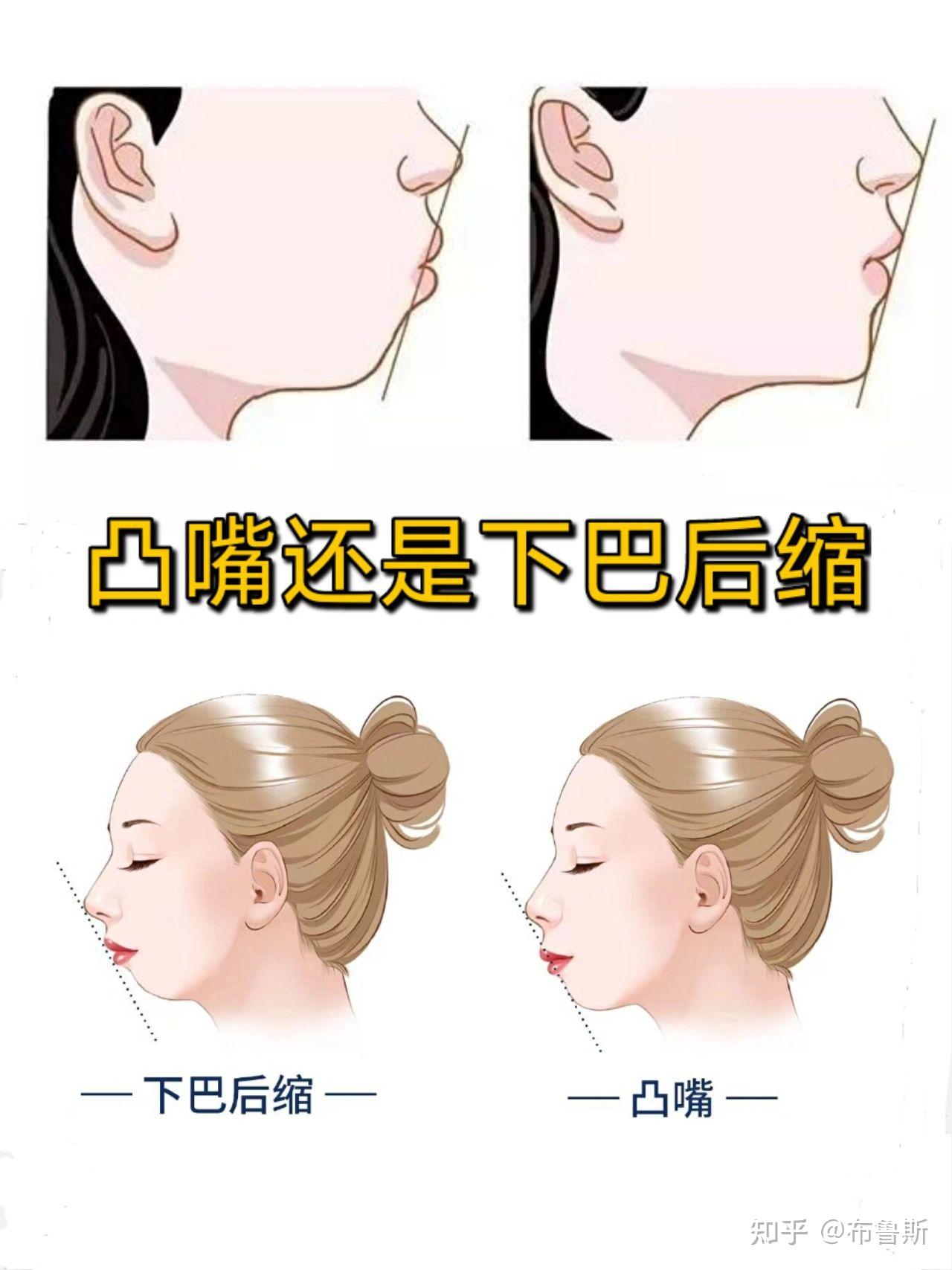 如何判断自己嘴凸还是下巴后缩? - _小百科