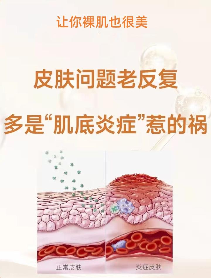 皮肤问题老反复,多是“肌底炎症”惹的祸 - 知乎