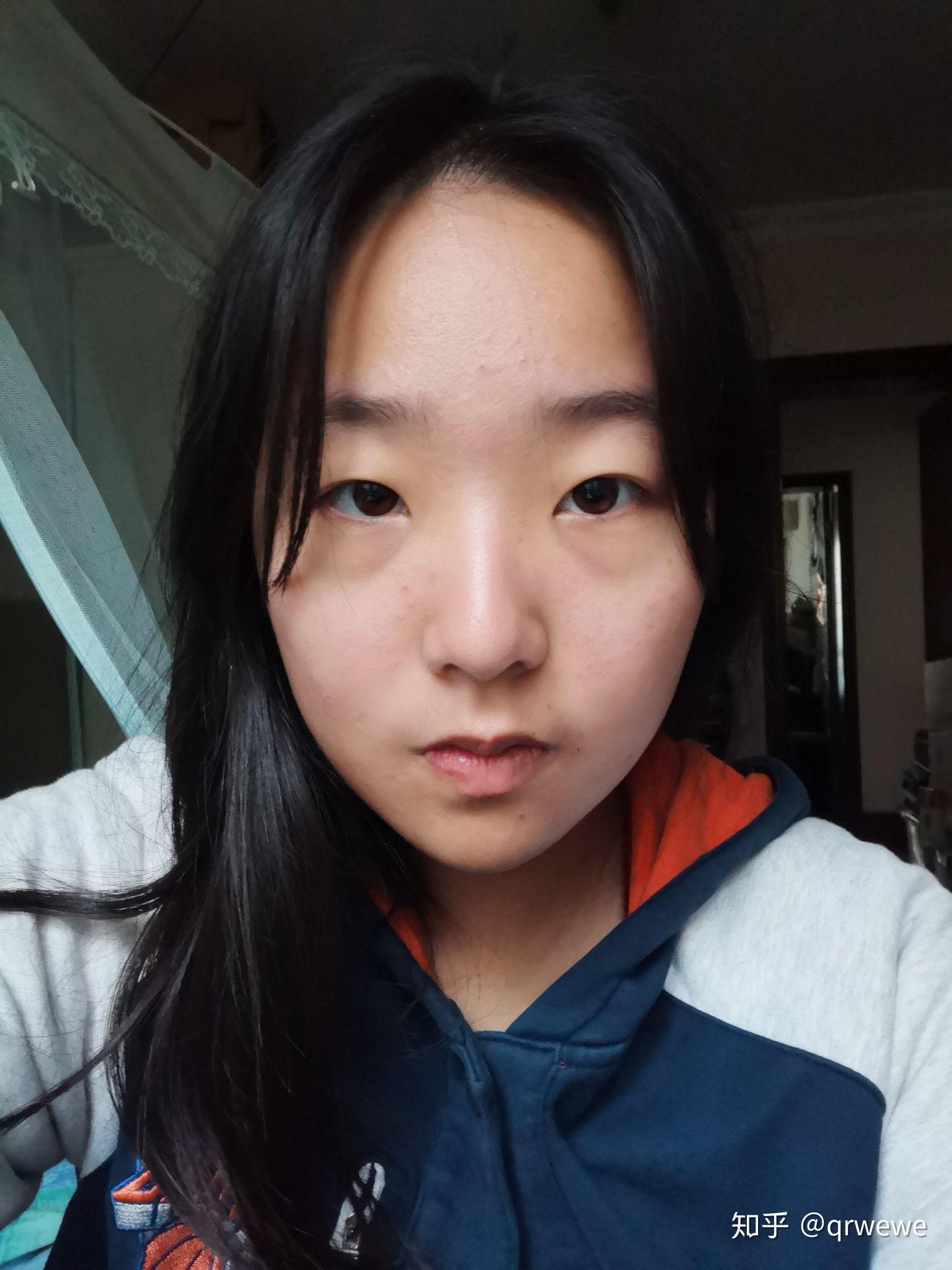 眼睛丑是怎样一种体验