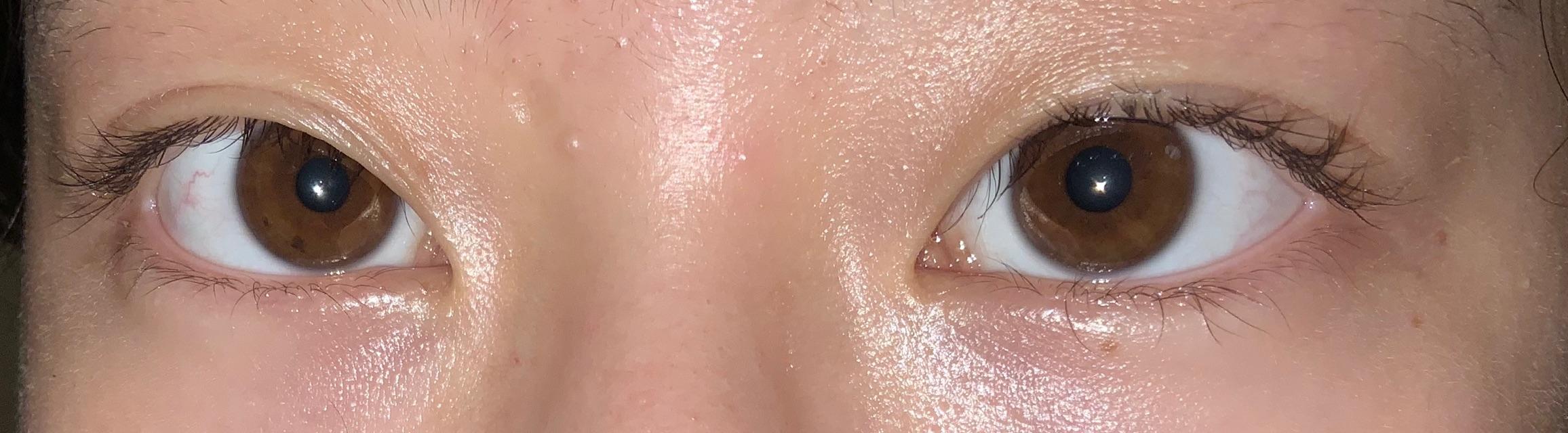 看别人的瞳孔都是褐色茶色觉得好漂亮啊? - 知乎