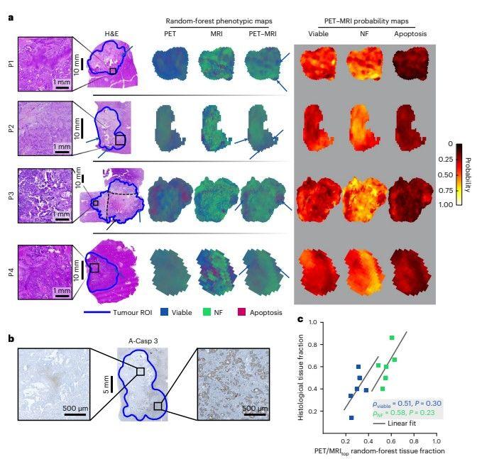 Nat Bio Eng | 德国专家完美匹配PET,MRI与病理图像，检测肿瘤异质性并提高治疗敏感性 - 知乎