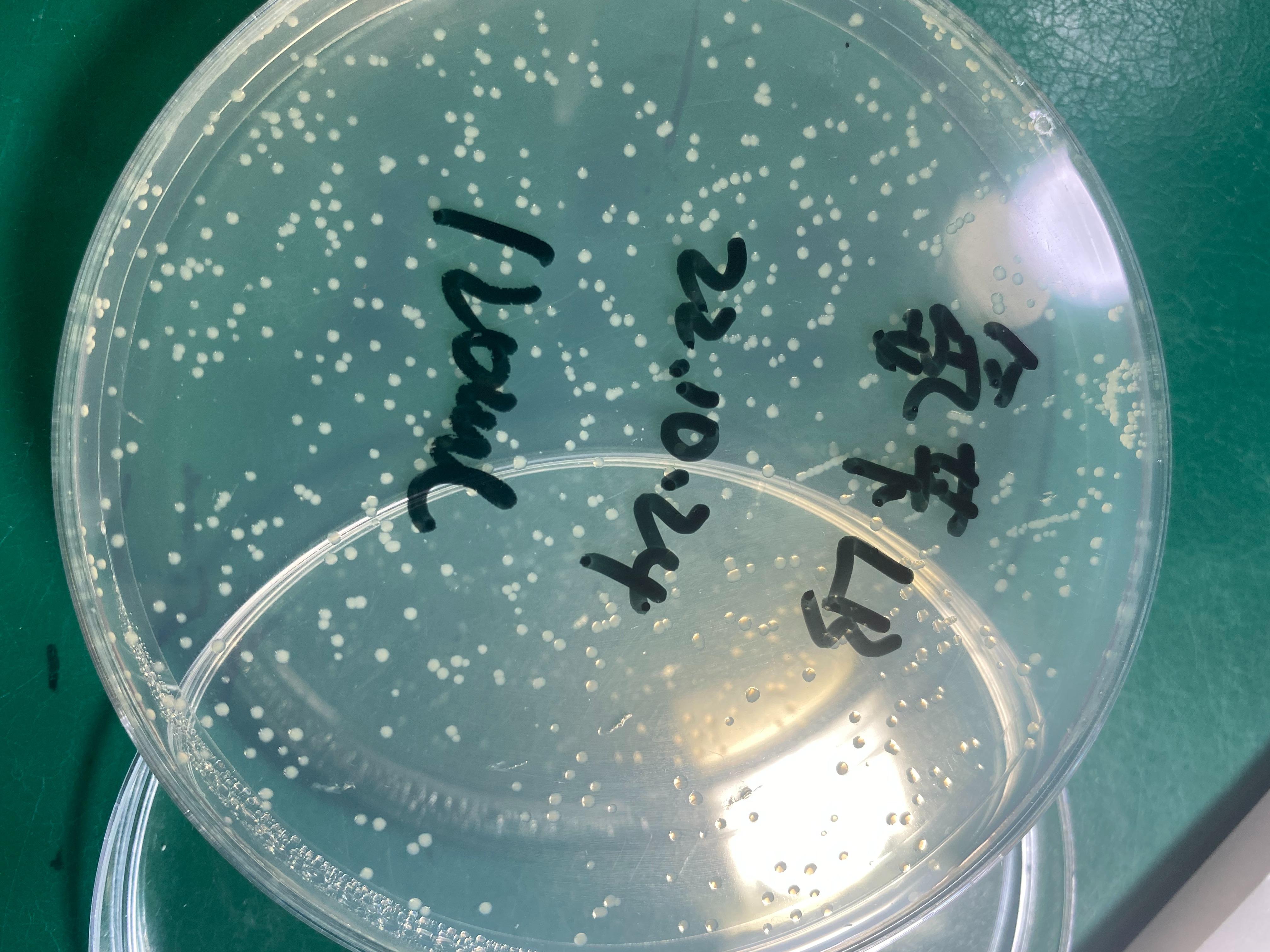 质粒转化实验测序测不出来lb平板长出这种菌是什么情况
