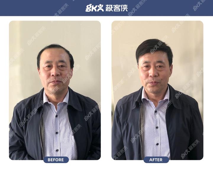 白头发多怎么办?【白发必读】 - 知乎