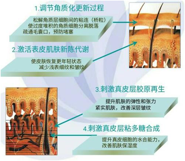 刷酸是浓度越高效果越好吗? - 知乎