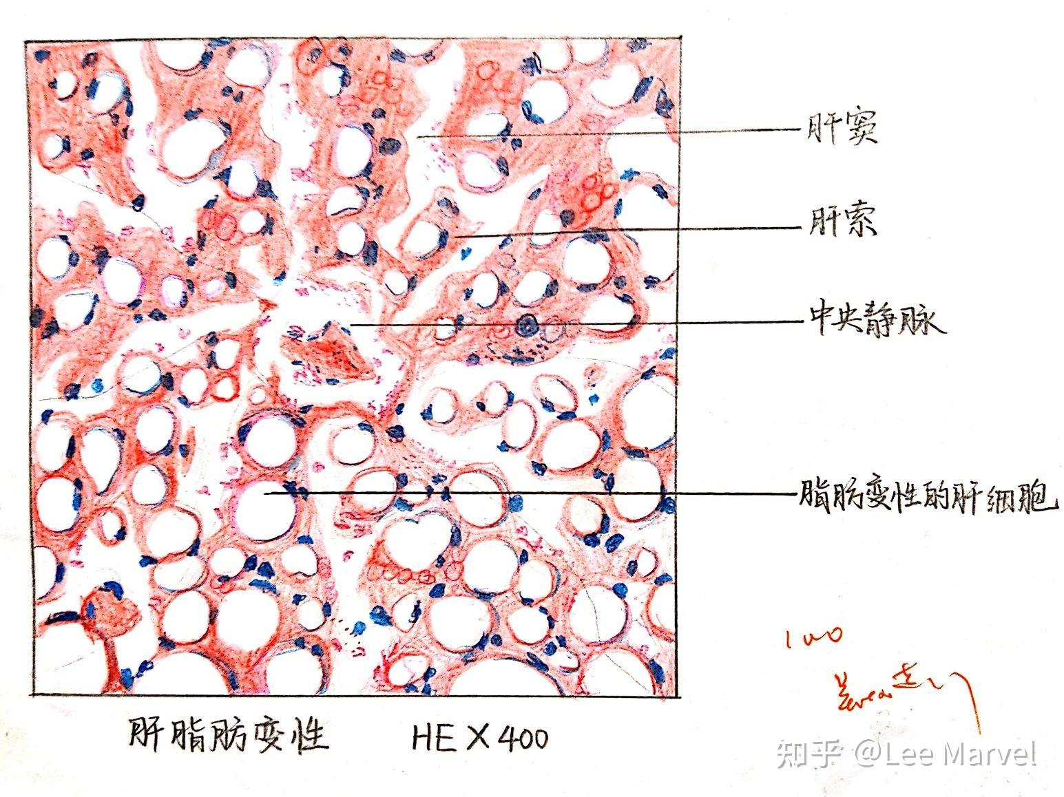 為什麼咱們不弄個病理紅藍手繪圖的問題呢