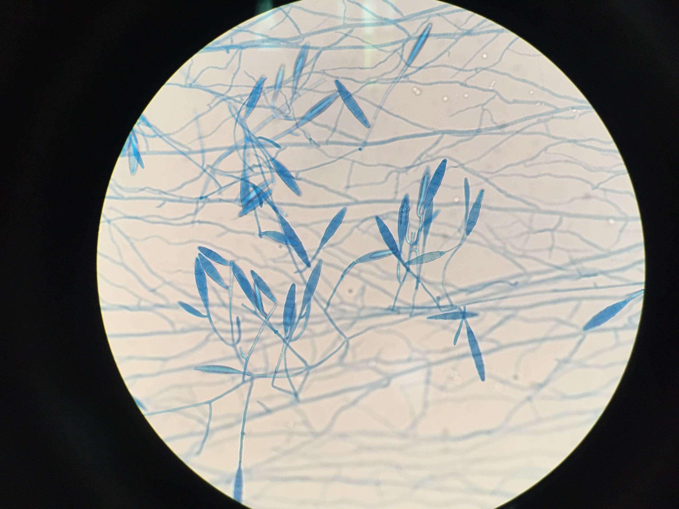 脚气真菌显微镜图片
