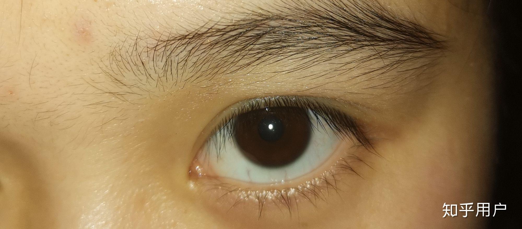 中国人眼球不是黑色么为什么好多人是棕色的我就是还有其他颜色吗