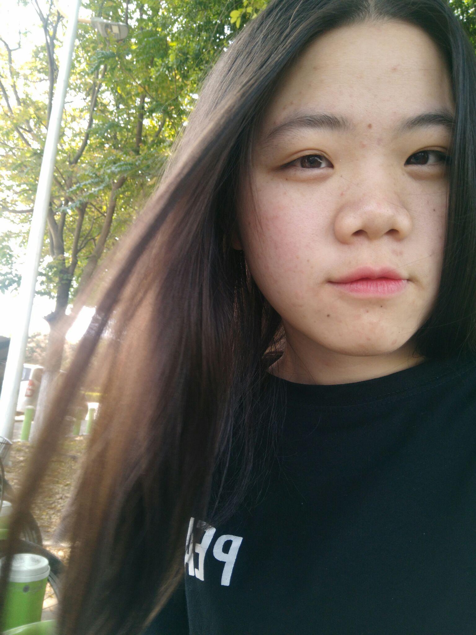 有没有因为鼻子不好看而毁了整张脸的例子?