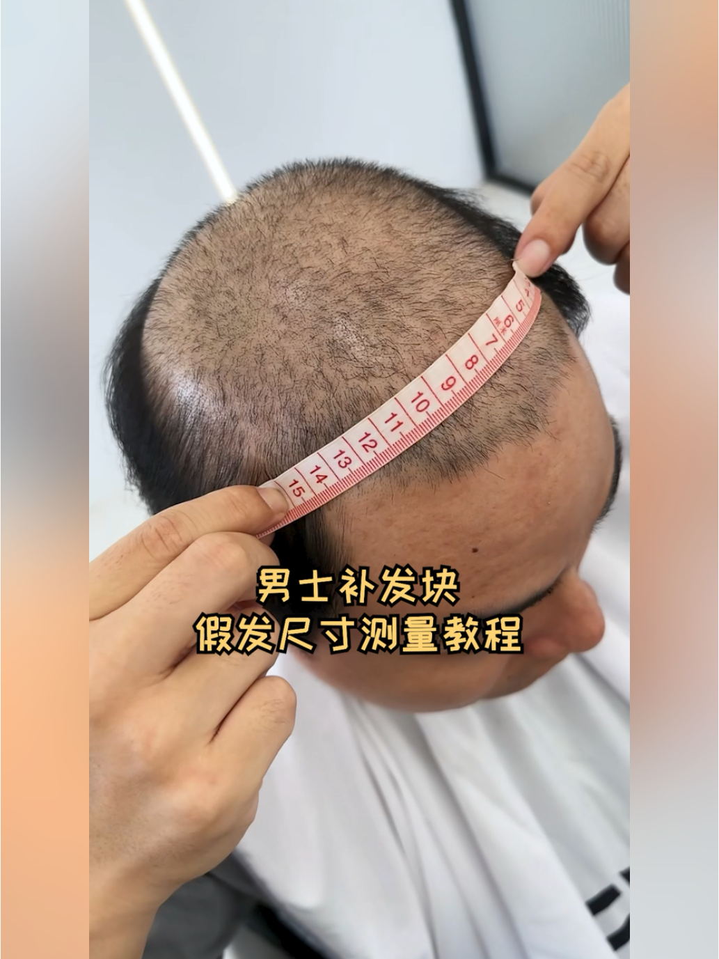 男士选假发片第一步,如何测量头顶面积!