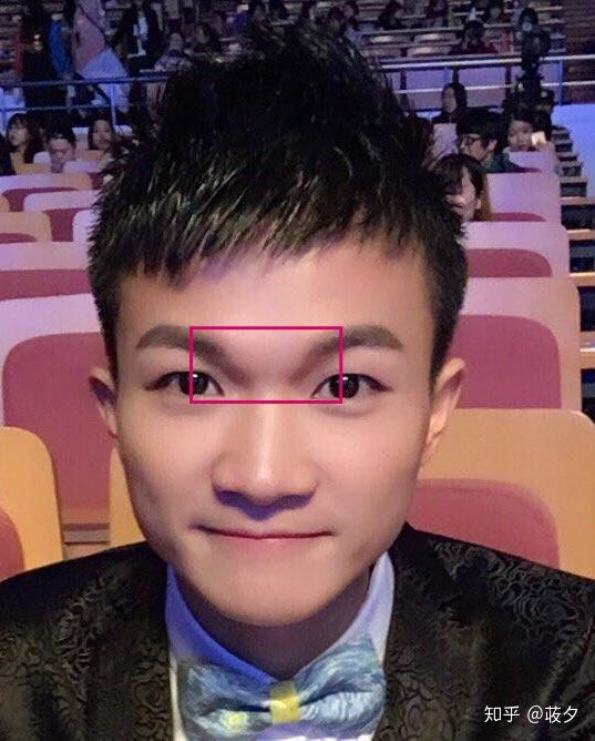 请问周深整容了吗