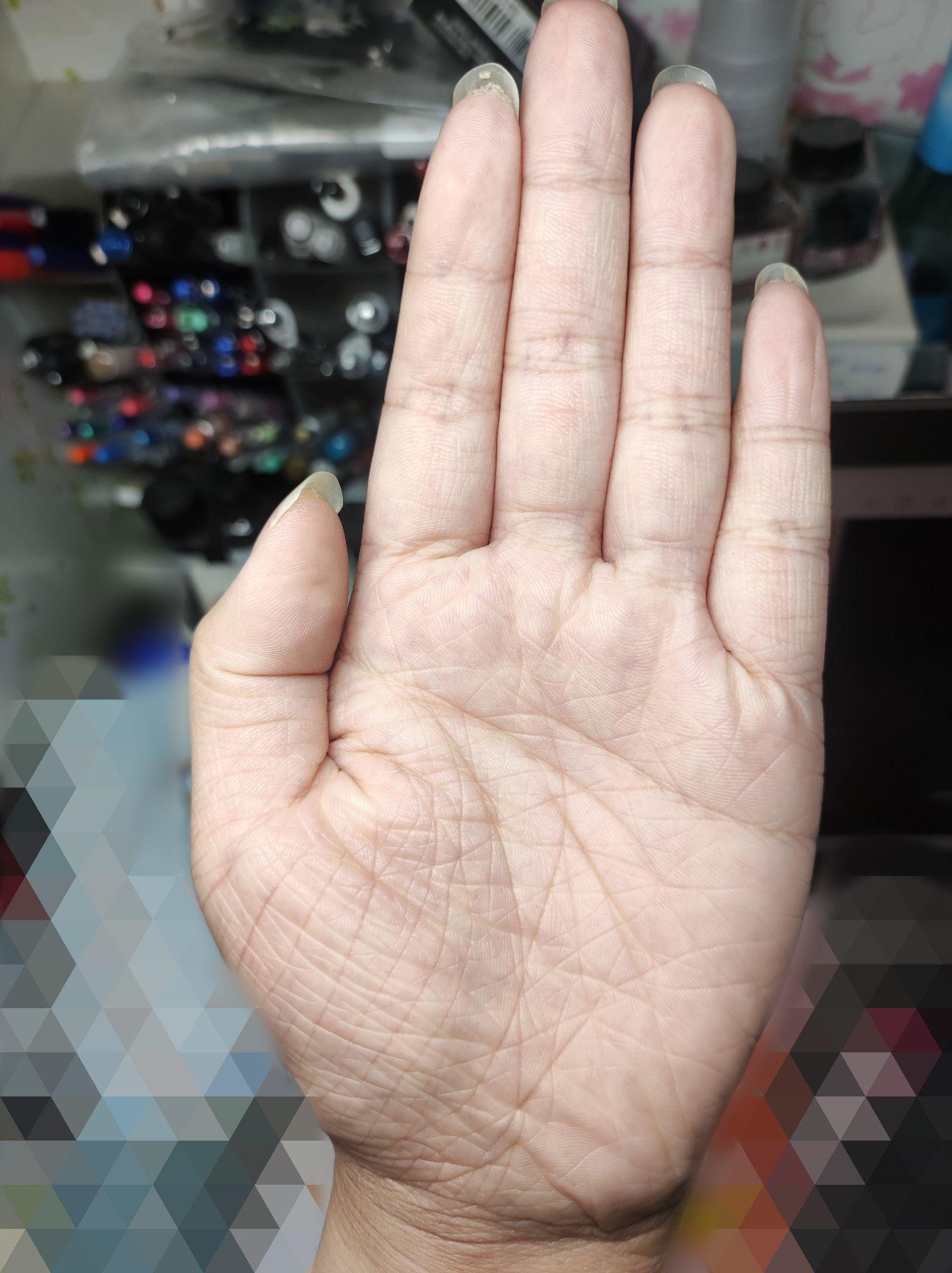 手掌天生粗糙纹路多 有希望解决吗? - 知乎