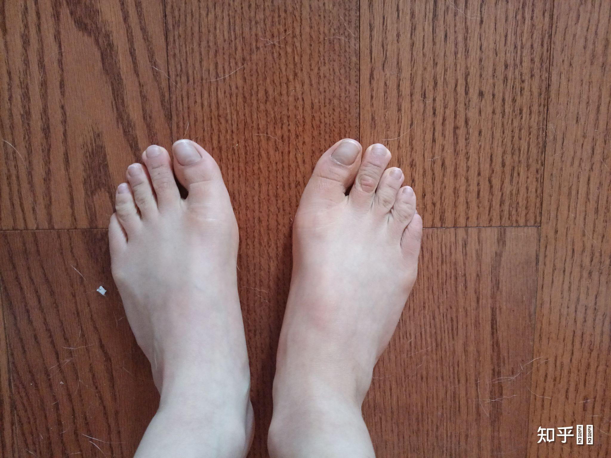 女生有一双很丑的脚有什么体验