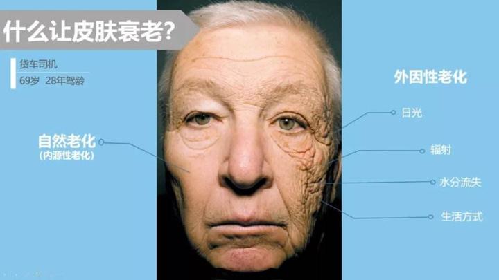 皮肤的自然老化和光老化 - 知乎