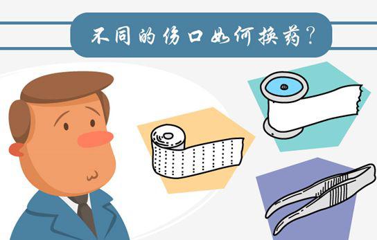 双眼皮手术必须来医院换药吗