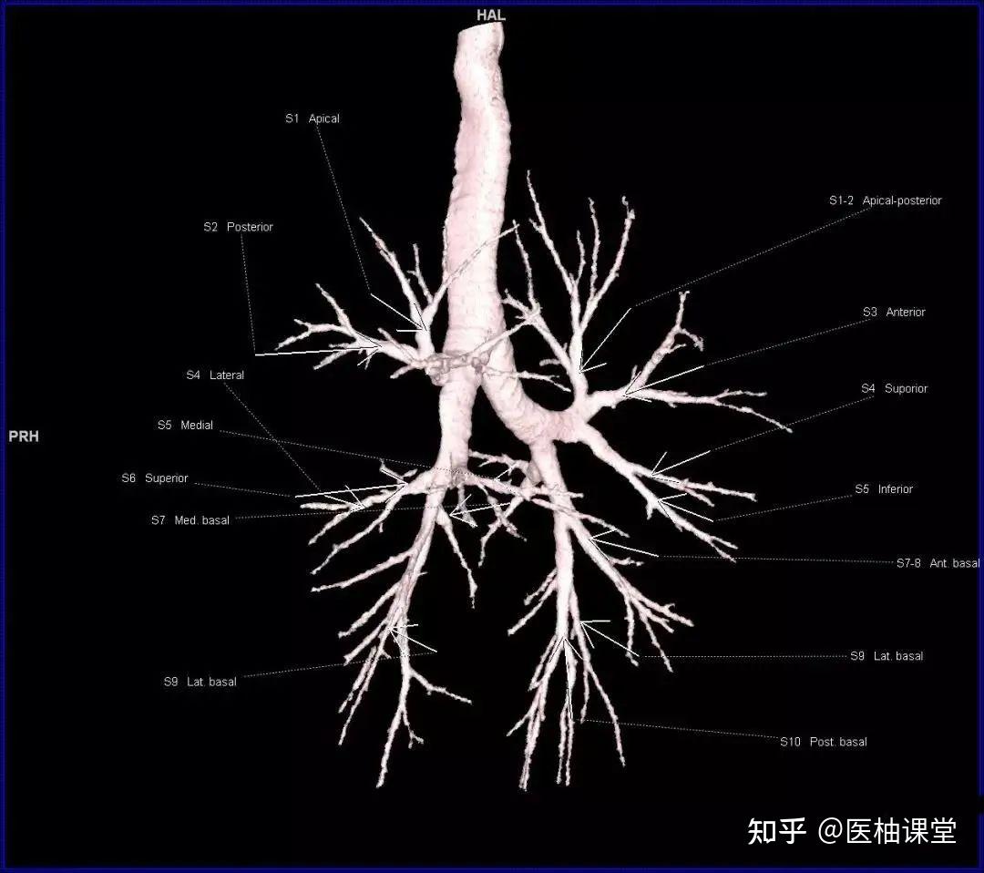 非常详细的肺部影像解剖 - 知乎