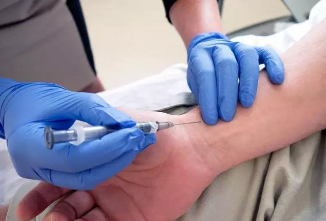 手把手教会护士正确的动脉采血部位方法