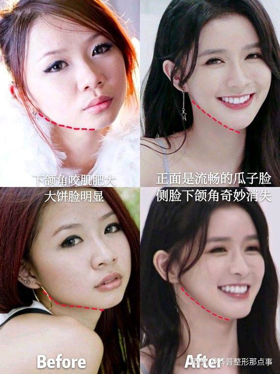 蔡卓宜是整容脸吗