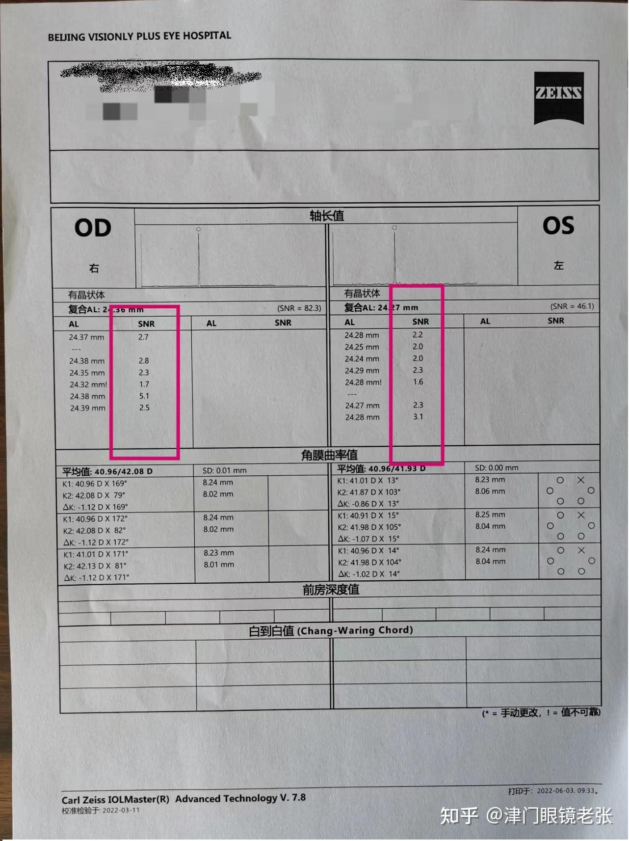 孩子配眼鏡需要測眼軸需要使用生物測量儀嗎