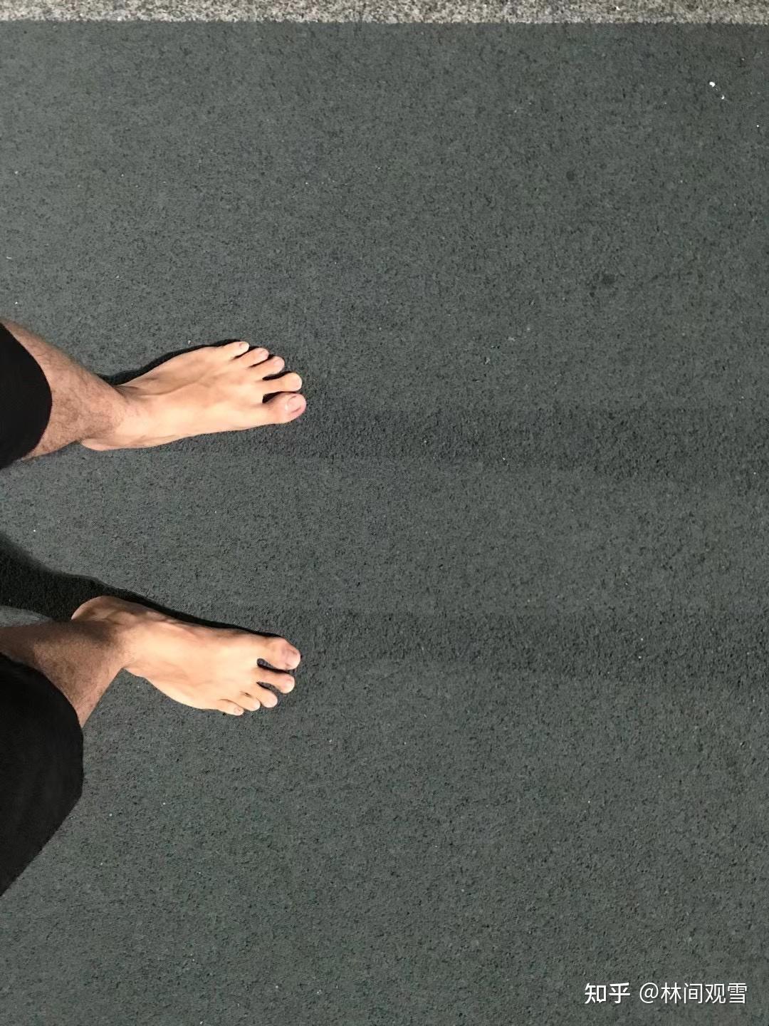赤脚跑步跑出一脚老茧是什么样的体验