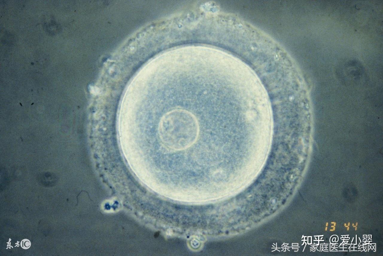 多囊软巢容易怀孕吗? - 知乎