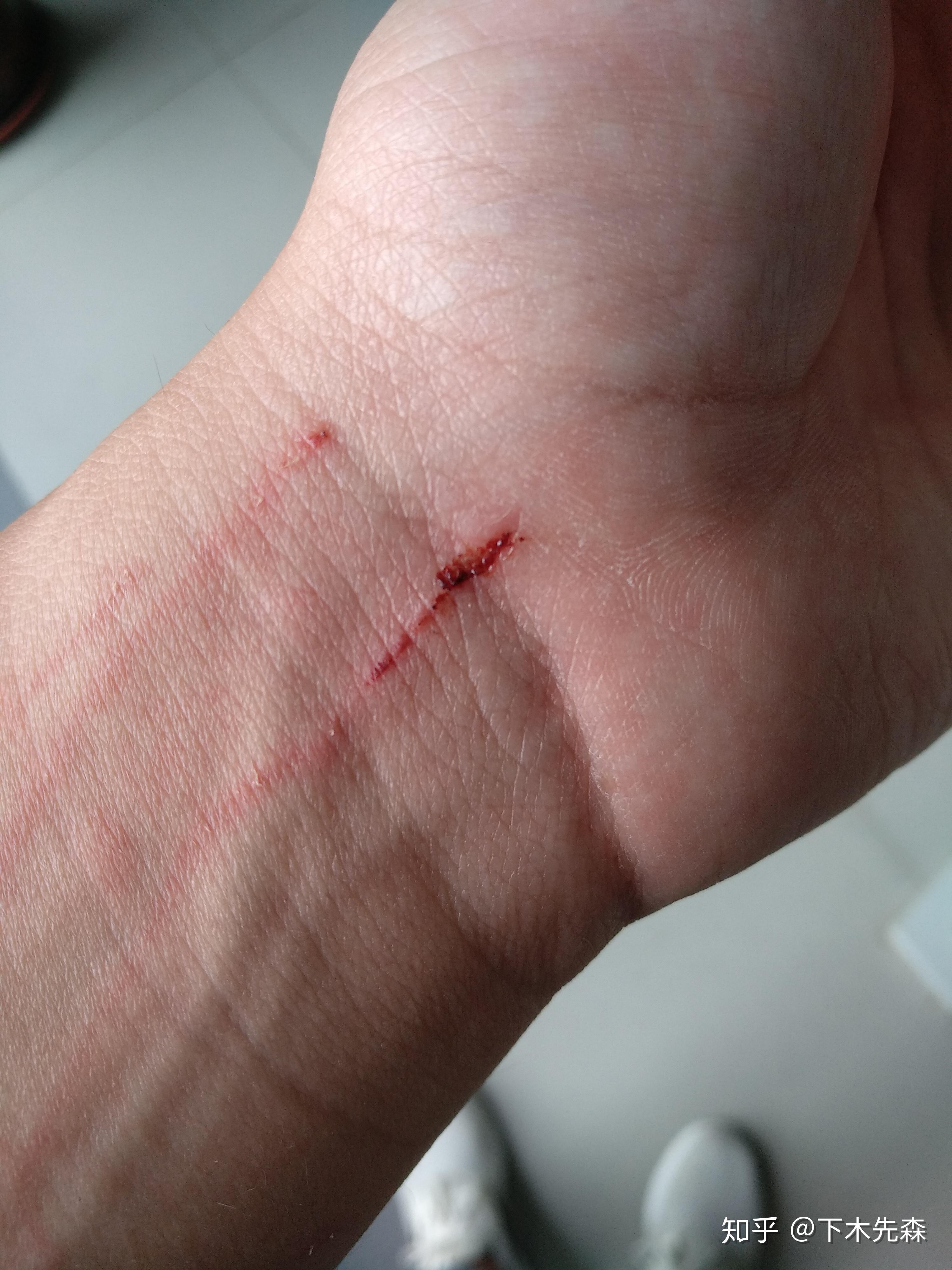 为何一些初中生,高中生会自残? - 知乎