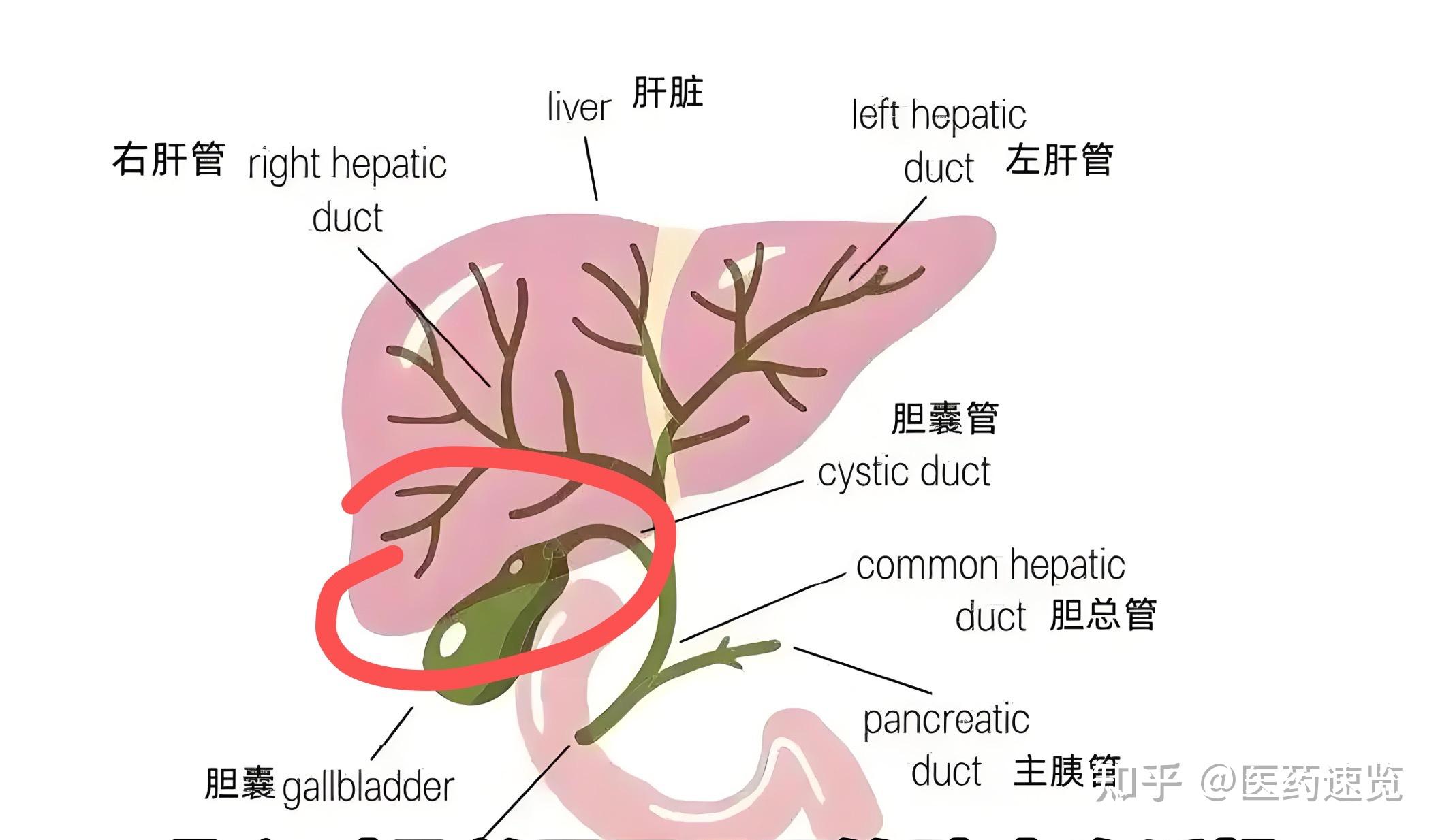 如何在胆囊癌早期阶段甚至原位癌阶段就能明确诊断?需要做什么检查?