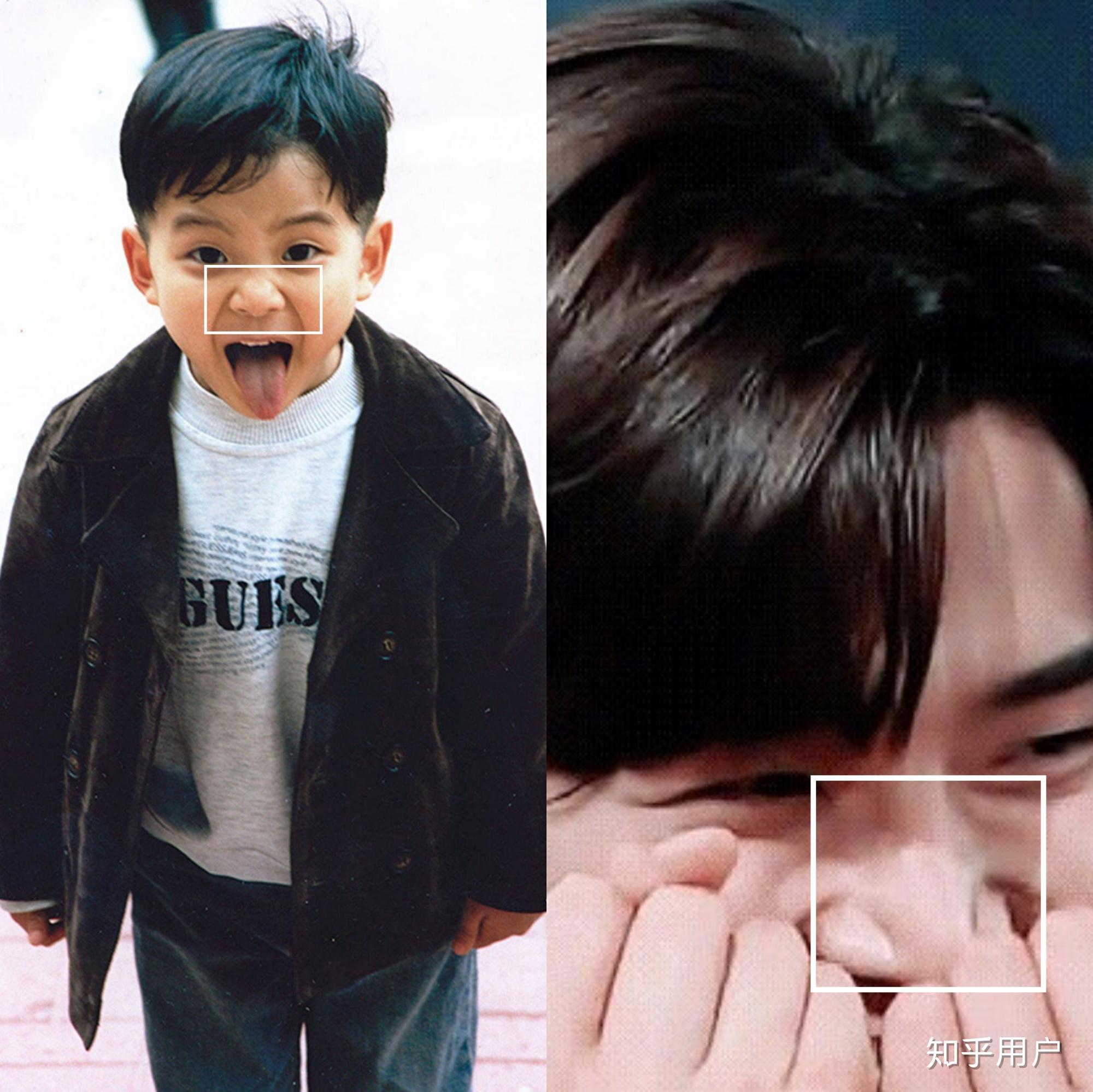 金路云整容了吗