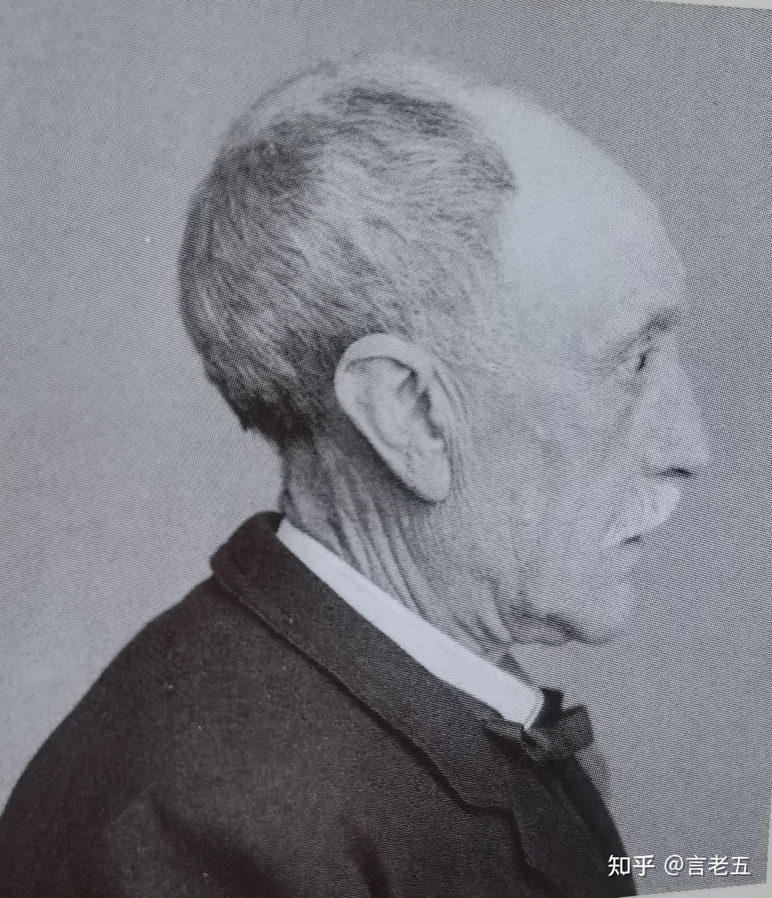 超级大的后脑勺,好自卑啊,怎么办,? - 知乎