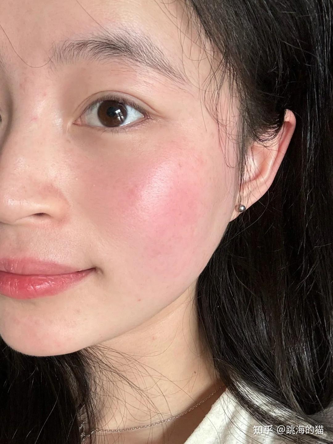 脸部总是泛红用什么护肤品比较好