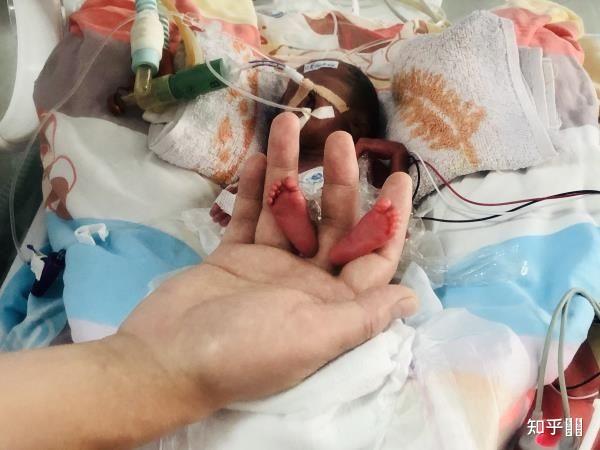 28周早产儿放保温箱多少天能过危险期?