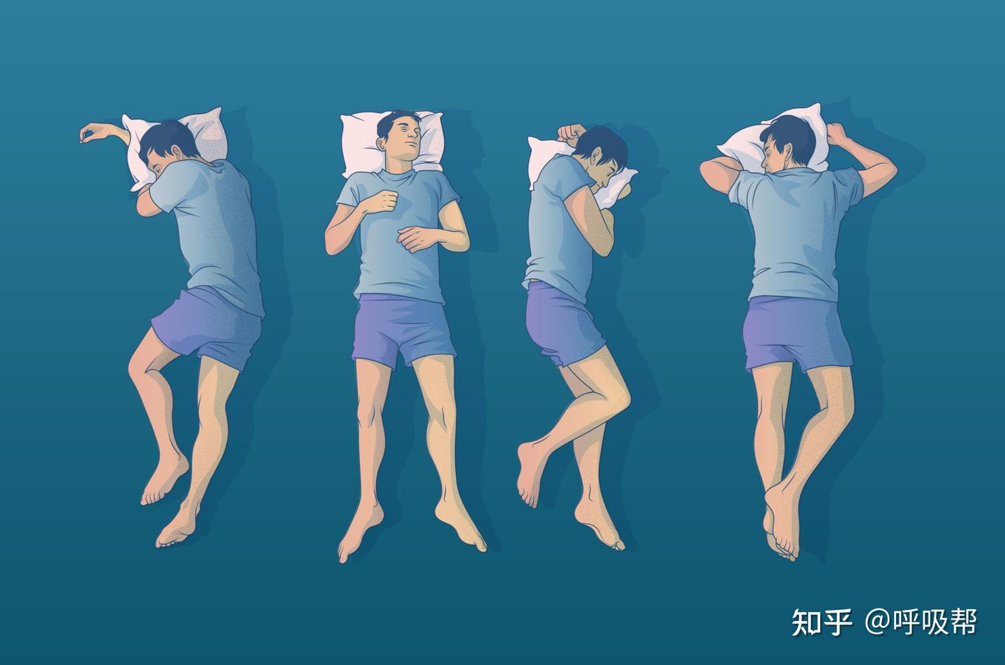 仰卧、俯卧、侧卧……如果您患有睡眠呼吸暂停症,最好的睡眠方式是什么? - 知乎