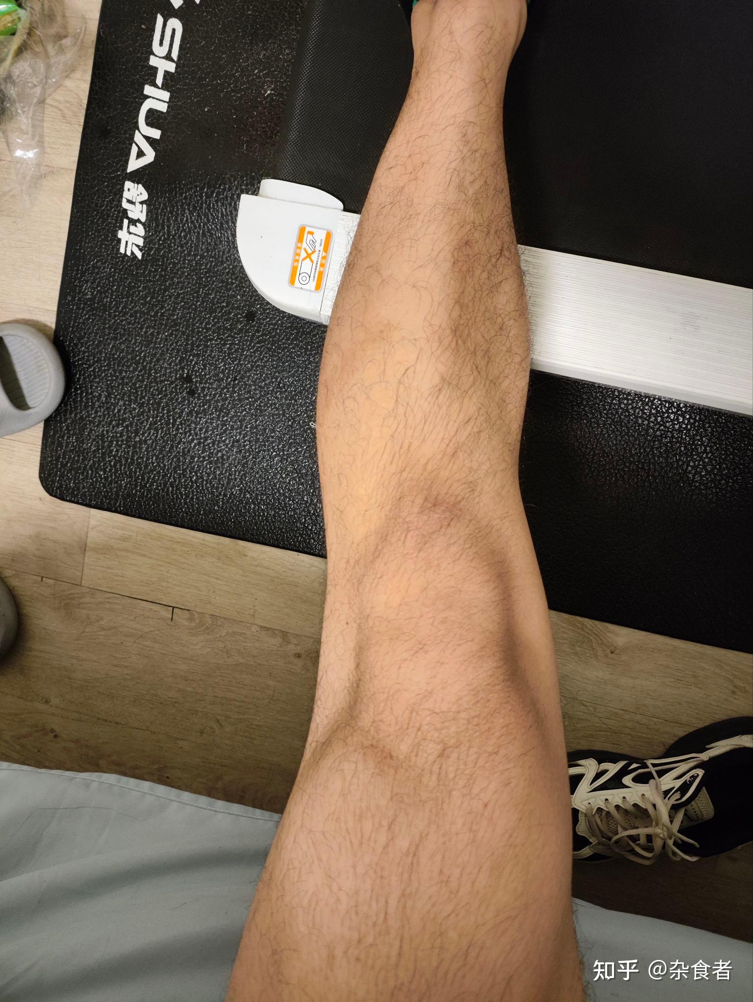 男生腿粗是一种怎样的体验?